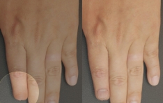 ����� �ճ��� ����� �׸��ϴ١� �������ǷἾ�� ���׸��հ����� ķ���� ����